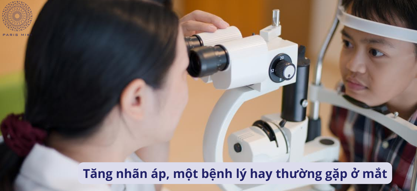 Tăng nhãn áp, một bệnh lý hay thường gặp ở mắt